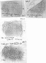 Thumbnail of Group of rubbings of IMEMITVOBON die 1
