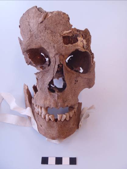 Human skull from Tyne and Wear Museums